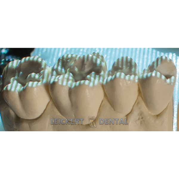 LEICKERT-DENTAL - CAD/CAM Anti-Reflective Spray 400 ml