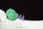 Adhesive Bondings for combined dentures - assortment